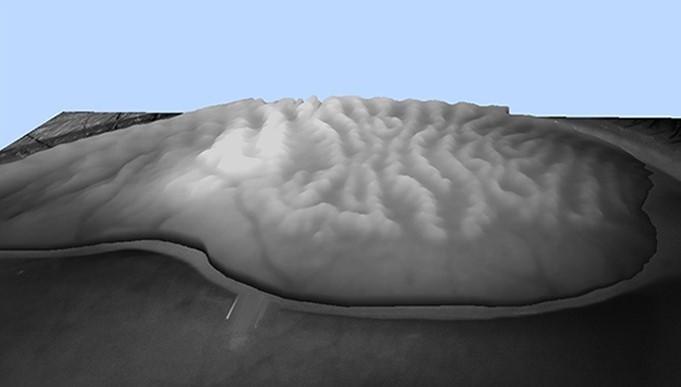 3D Meibography
