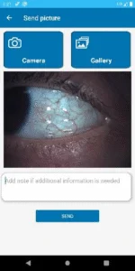 Dry Eye Follow up App Send Photo