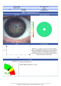 Dry Eye Report NIBUT