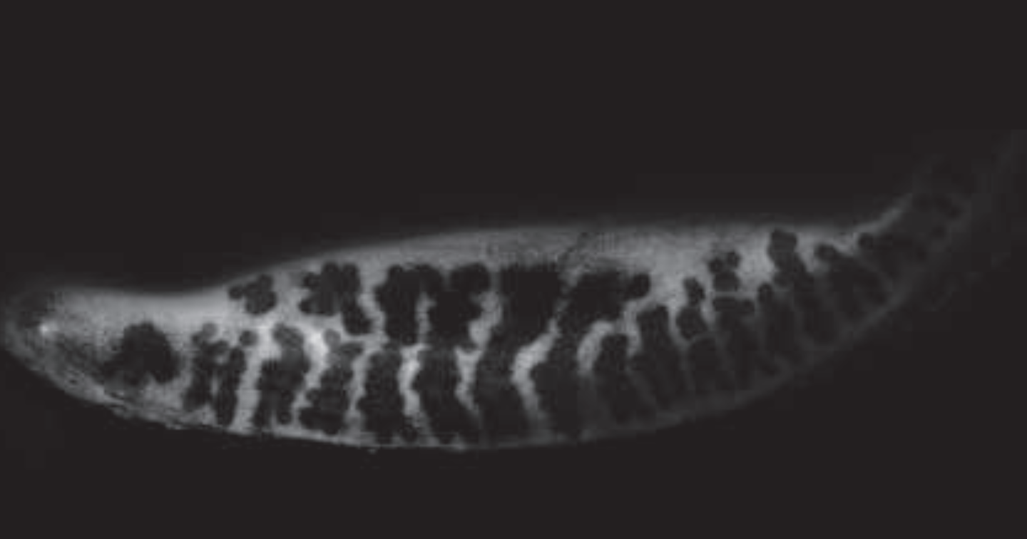 Transillumination Meibography